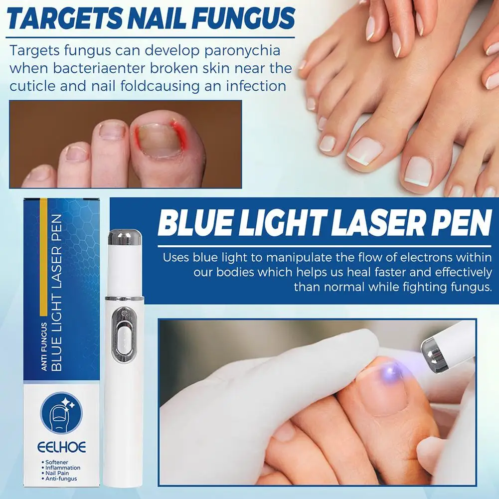 Nail Fungus Treatment Pen Anti-fungal Repair Pen Blue Light Laser Paronychia Nail Onychomycosis Painless Removal Care Tool