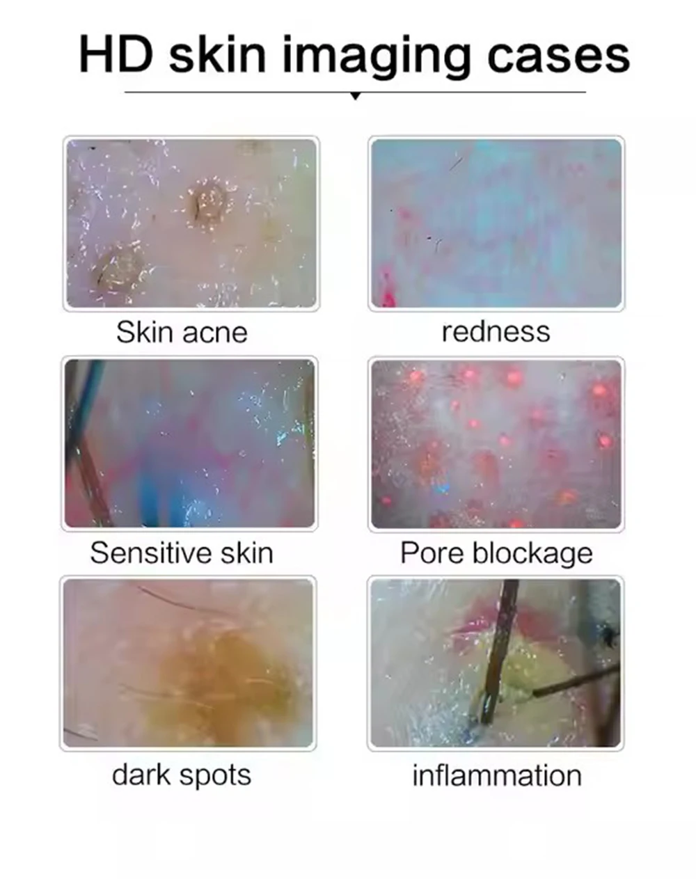 10 Inch LCD Digital Hair Skin Analyzer Scalp Detector Microscope for Hair Follicle Testing and Skin Analysis Magnifier 50/200X