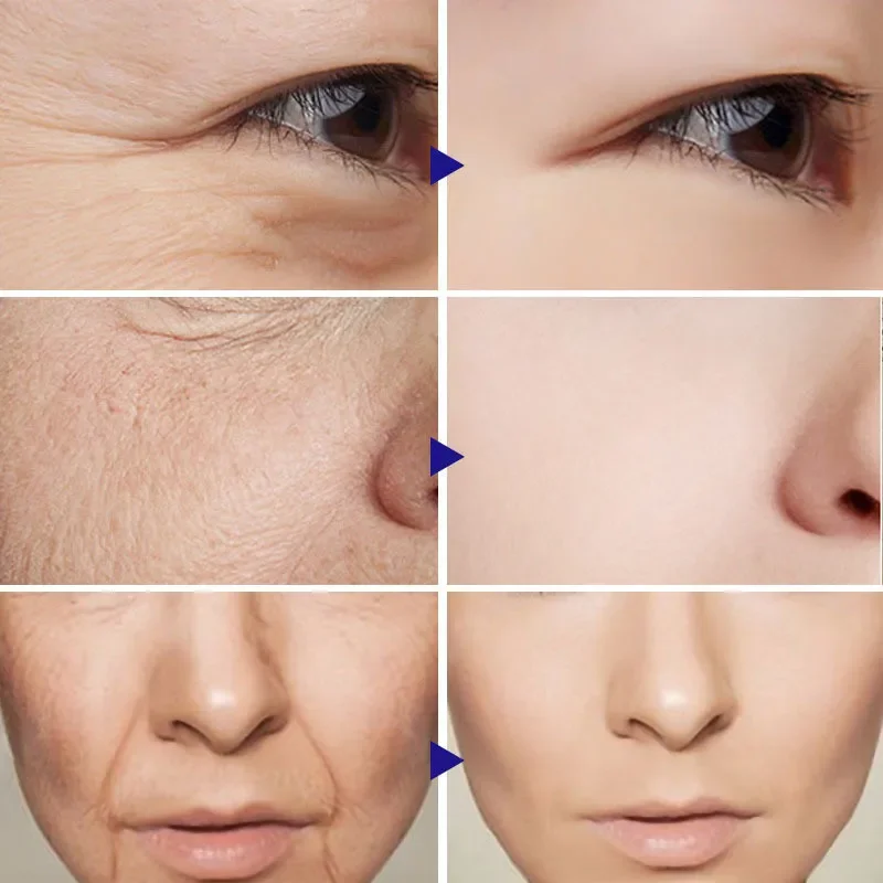 Collagen Multi Balm Stick Wrinkle Anti-Aging Moisturizing Fade Fine Lines Improve Brighten Dull Skin Tone Cream Korean Cosmetics
