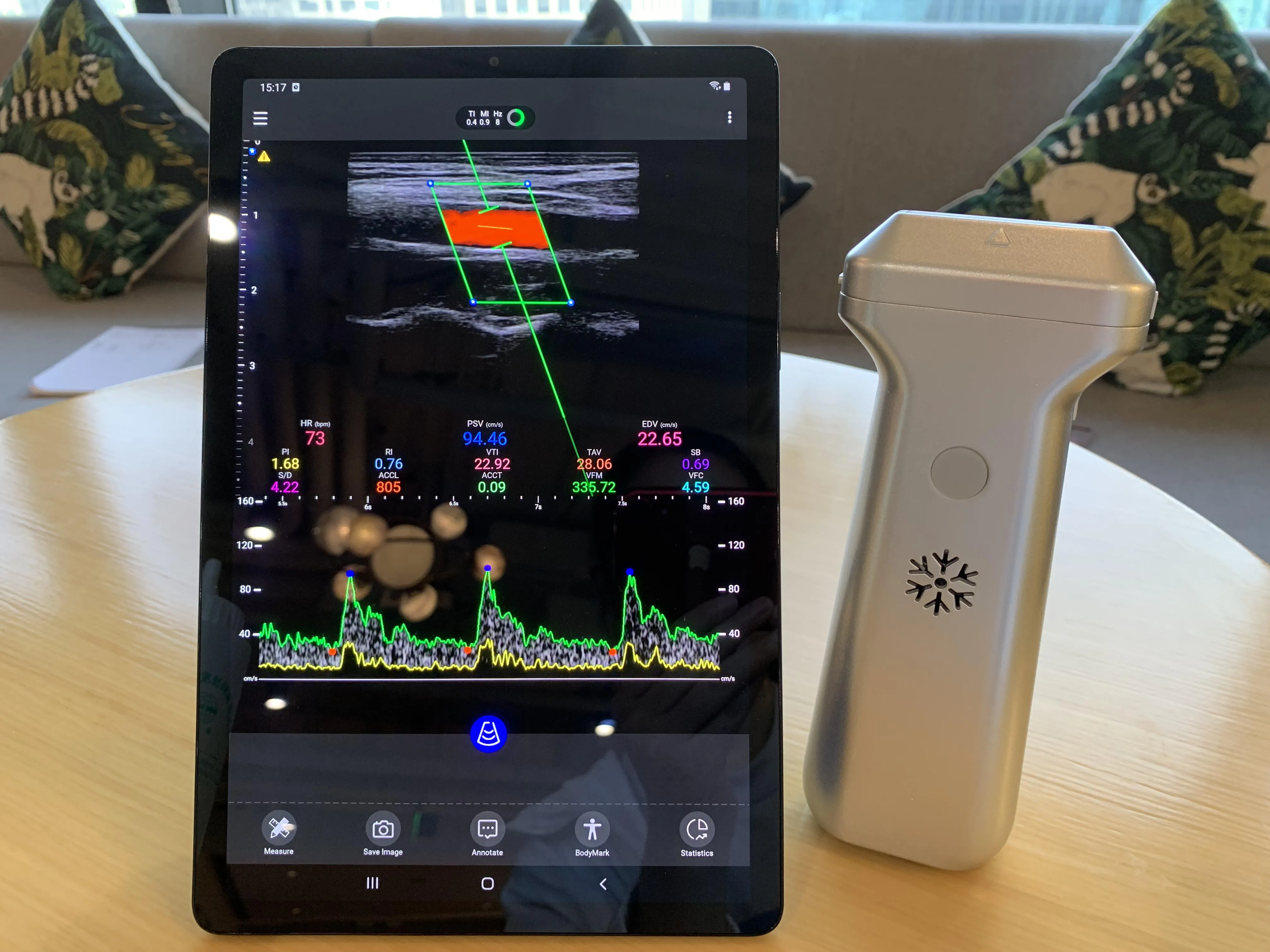 Рисунок 5 - Портативный беспроводной цветной Доплер