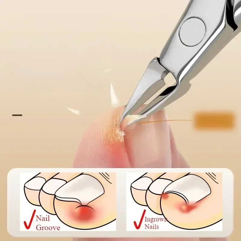 NEW Nail Clippers Toenail Cutters Pedicure Manicure Tools Anti-Splash Ingrown Paronychia Professional Correction Tool Sets