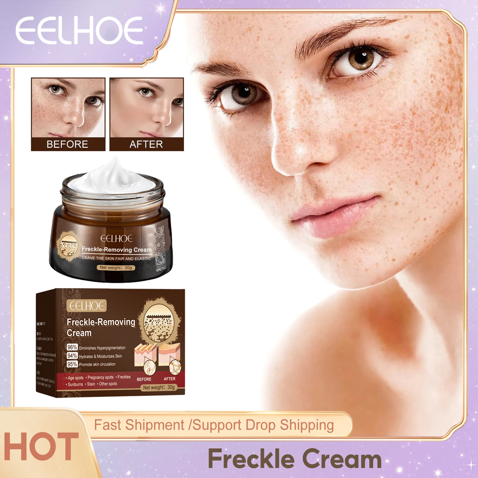 Whitening Freckles Cream Fade Pigmentation Lighten Melanin Moisturize Hydrating Remover Acne Mark Anti Dark Spots Brighten Cream