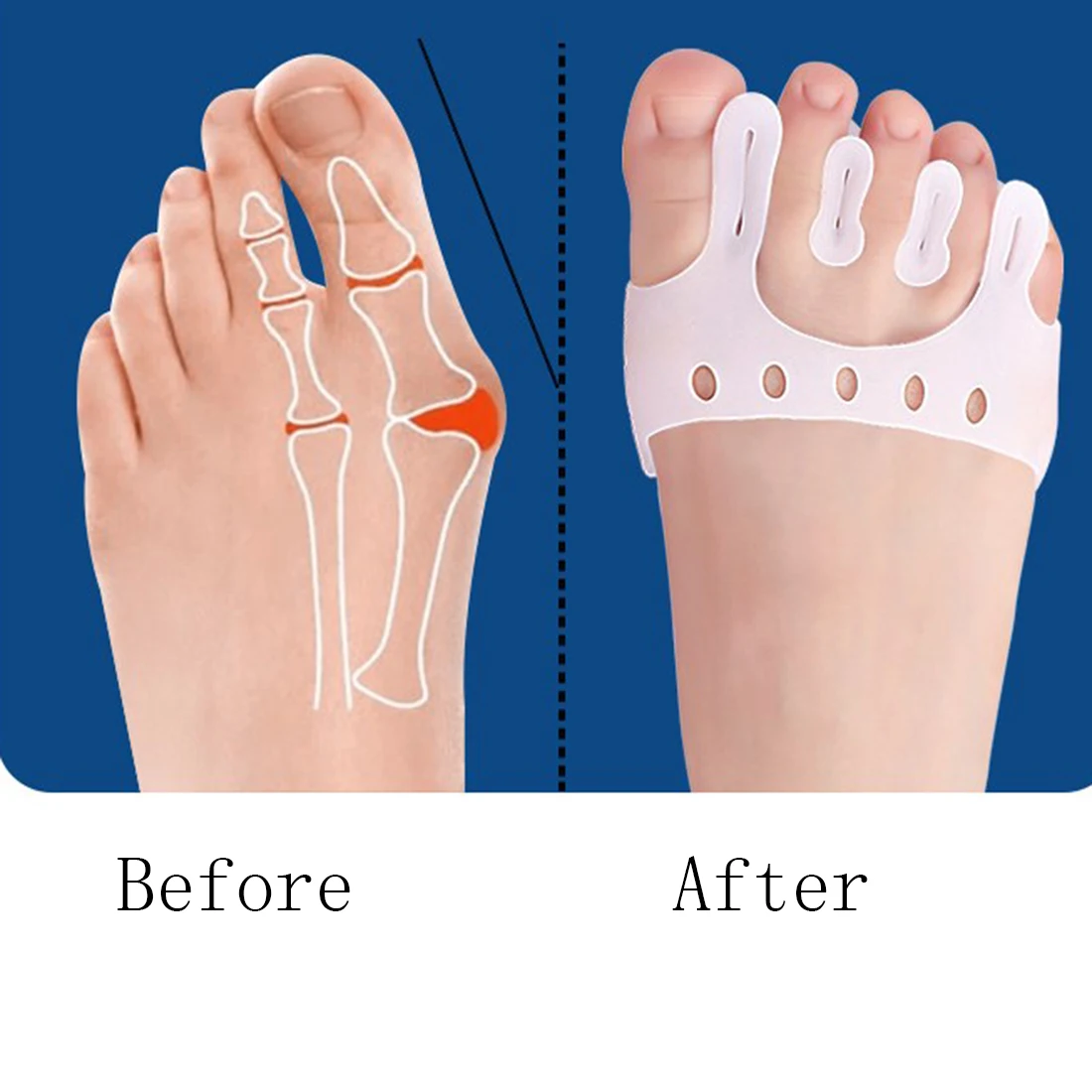 High Quality Foot Bone Overlap Protector Daily Silicone Gel Foot Toe Separator Finger Separator
