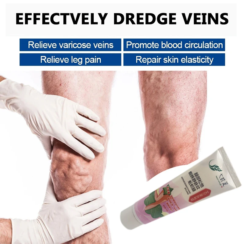 

3pcs 20g Varicose Vein Ointment Legs Dilated Vasculitis Pain Care Cream Earthworm Vein Repair Phlebitis Analgesics Dressing