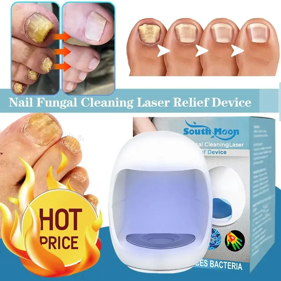 NailFungusLaserTreatmentDeviceRepairToenailFingernailFungus