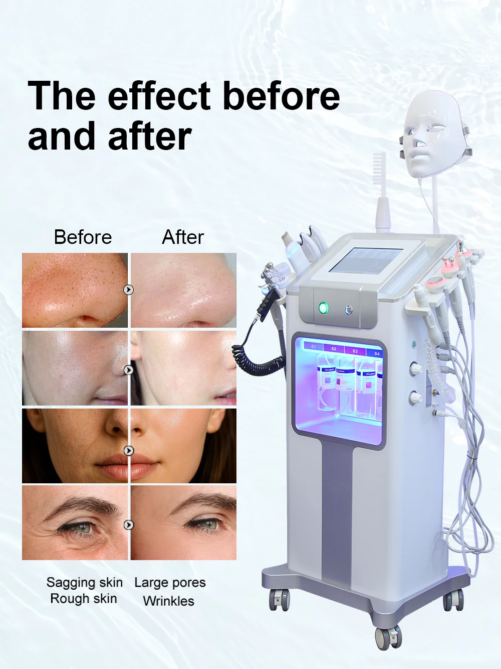 AOKO 13-in-1 professionelle Hydro-Dermabrasionsmaschine, Wasser-Sauerstoff-Hautwäscher, Tiefenreinigung der Gesichtsreinigung, Spa-Maschine zur Porenentfernung – Detail 4