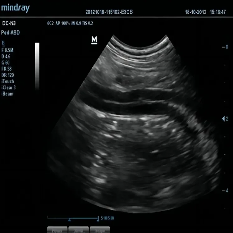 Рисунок 5 - EC Mindray ультразвуковой компактный сканер животных