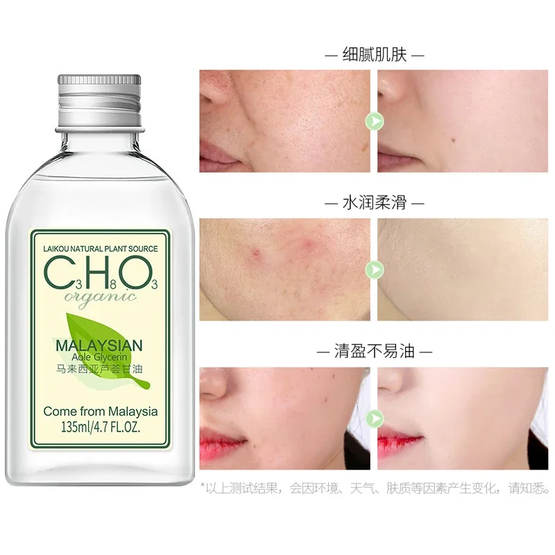 

Масло Алоэ Вера; Гель из чистого натурального органического глицерина алоэ вера для лица, волос и тела, сухое поврежденное старение кожи, уход за кожей от акне