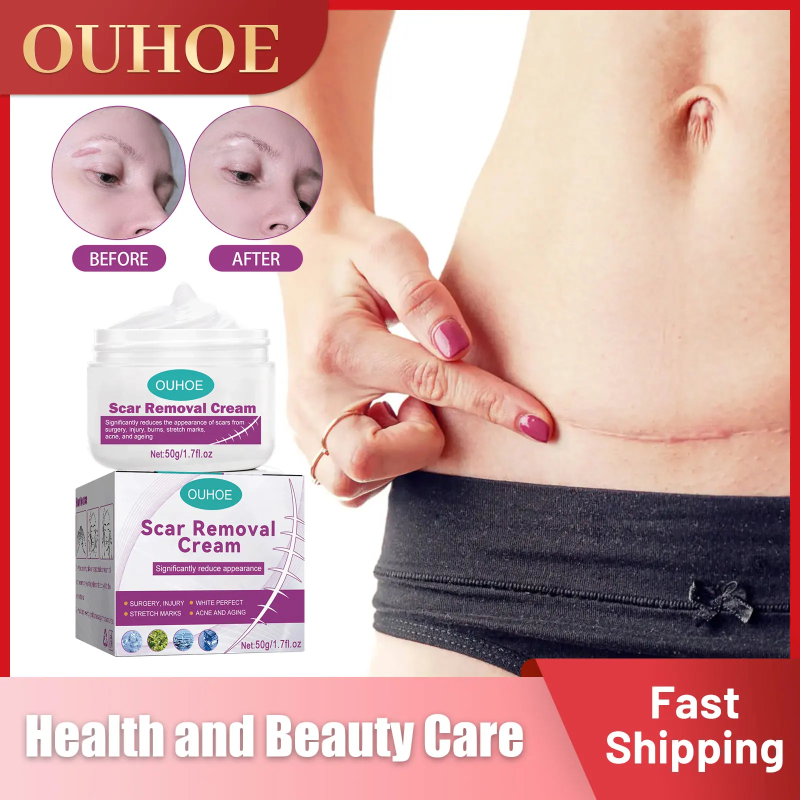 

Scar Repair Cream Stretch Marks Burn Surgical Removal Whitening Fade Spots Pimple Mark Moisturize Smooth Skin Scar Removal Cream