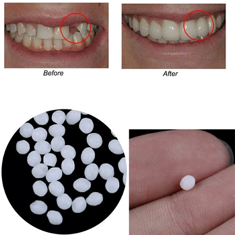 

100g Resin False Teeth Solid Glue Temporary Repair Kit and Gap Denture Adhesive Dentist
