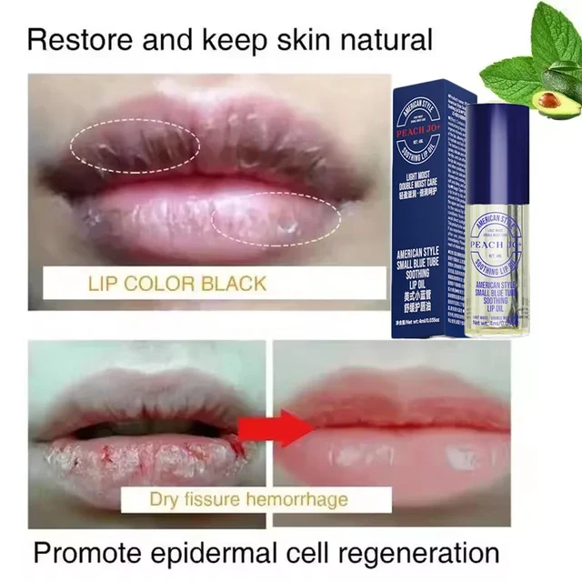 Fast Lightening Pink Mouth Lips Serum Bleaching Permanent Remove Dark Smoke Lips Lip Balm Moisturize Gloss Lipstick Lip Oil