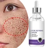 Skin Texture | Pore Refining Resurfacing, Brightening Facial Serum with Retinol and Niacinamide Non-Comedogenic 1