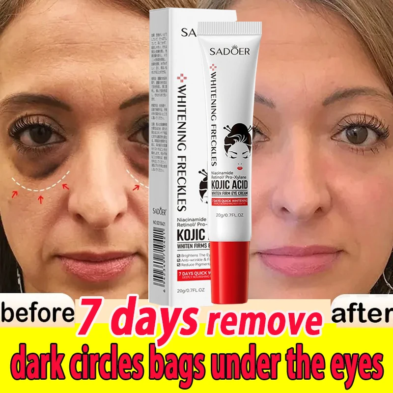 

﻿ Instant Eye Bag Dark Circles Removal Cream Firm Wrinkle Anti Fat Particles Fade Fine Lines Brighten Moisturize Korean Eye Care