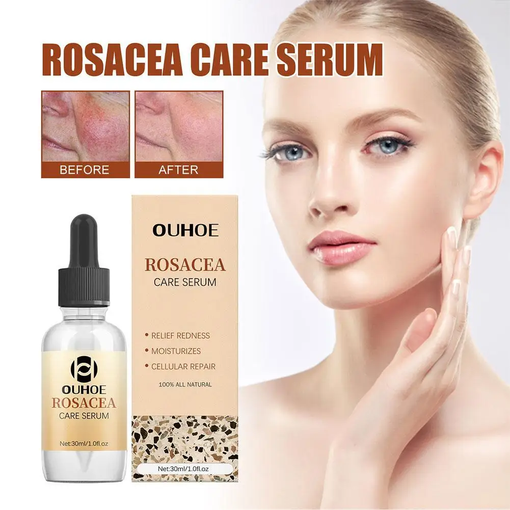 

30ml Rosacea Cure Serum Erythema Repair Essence Soothing And Moisturizing The Skin Facial Repair Serum Skin Care