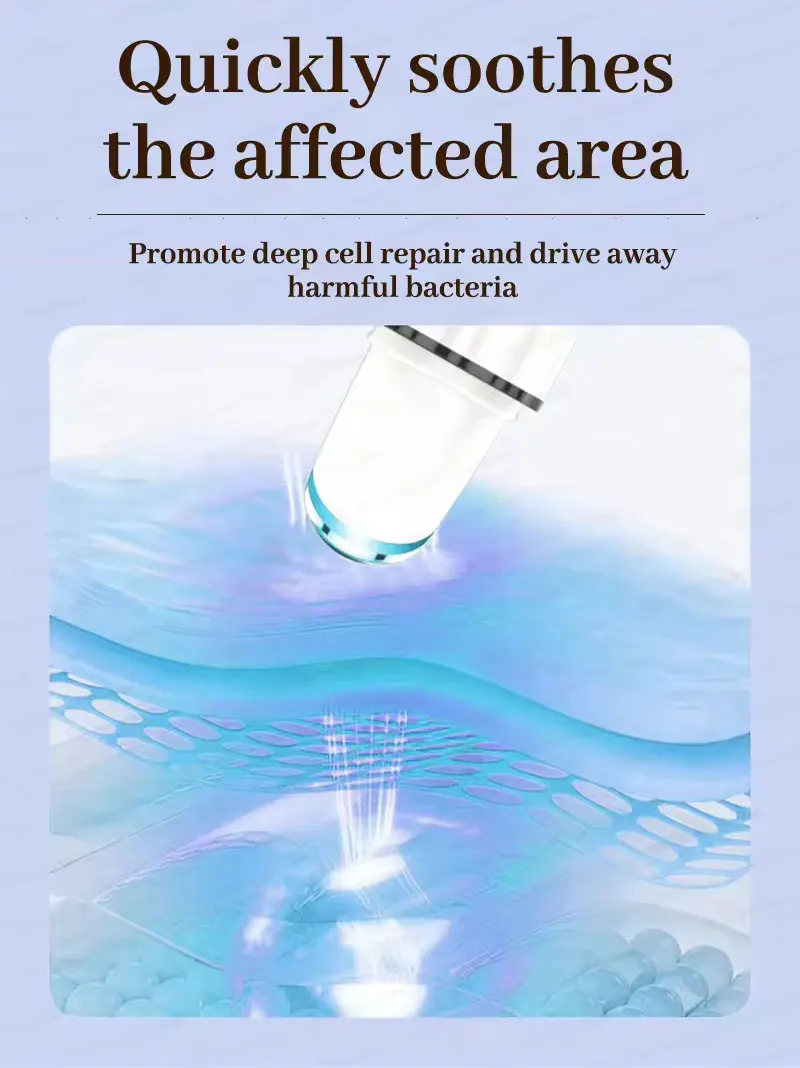 Penna a luce blu a massima potenza per la rimozione di verruche comuni e plantari, strumento per la cura delle verruche._voghion.com