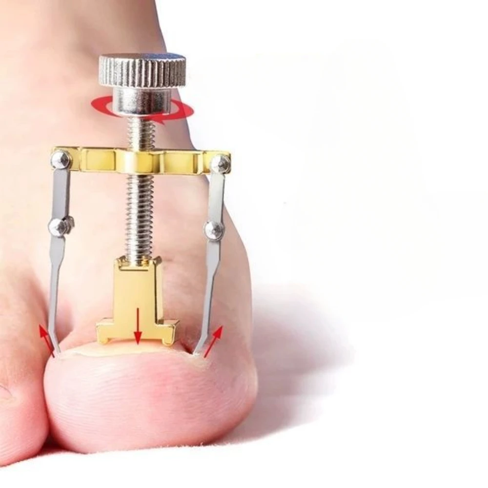 

Portable Stainless Steel Toenail Corrector Foot Health Care Tool Ingrown Toenail Lifter Ingrown Paronychia Painless Use