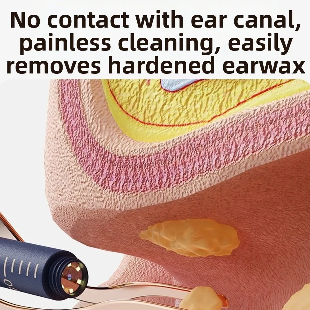 Hot EarSight Plus Smart Visual Ear Cleaner 6 LED Lights 1080P Ear Wax Removal Cleaner with tweezer Earpicks Ear Care