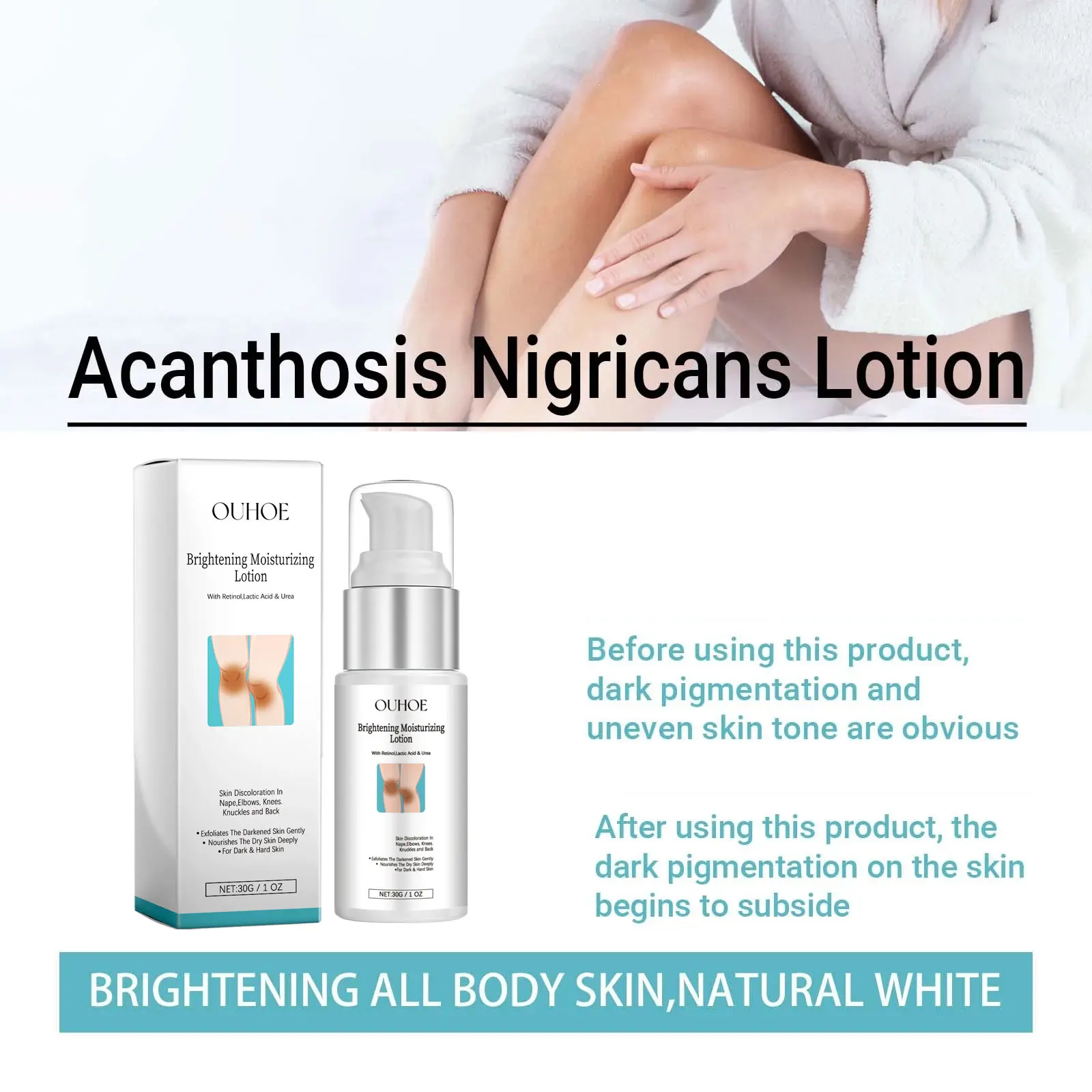 Body Whiten-ing Cream for Dark Skin Private Part Remove Melanin Pigmentation Bleach Brighten Acanthosis Nigricans Therapy Lotion 5