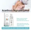 Body Whiten-ing Cream for Dark Skin Private Part Remove Melanin Pigmentation Bleach Brighten Acanthosis Nigricans Therapy Lotion 5