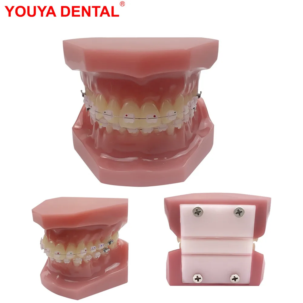 

Orthodontic Dental Teaching Model With Fully Ceramic Bracket Normal Standard Orthodontic Teeth Model For Studying Education Demo