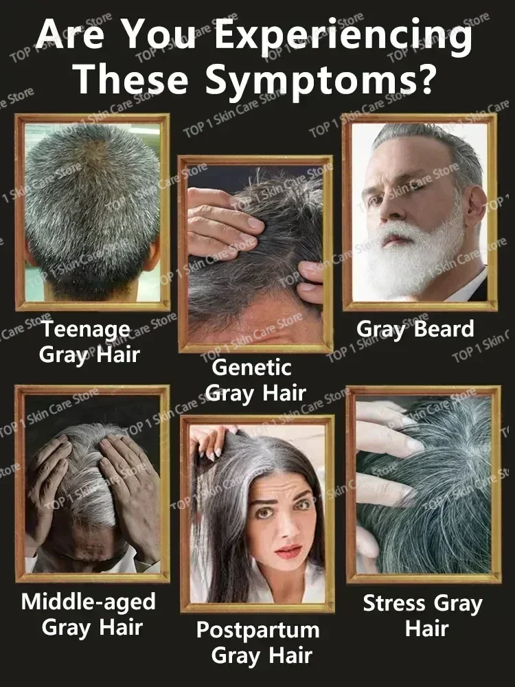 White hair killer, remove gray hair and restore natural color in 7 days