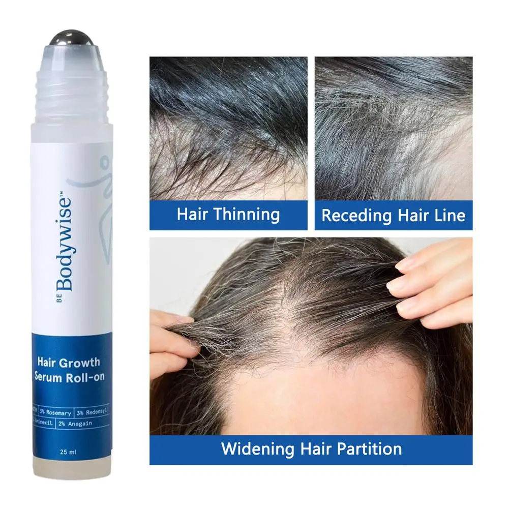 Siero per la crescita dei capelli al rosmarino da 25 ml al 3% - Nutrimento profondo del cuoio capelluto Controllo dell'effetto crespo Rafforza le radici dei capelli Olio essenziale per la cura dei capelli