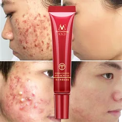15g Effective Acne Removal Cream Herbal Anti-acne Repair Fade Acne Spots Oil Control Whitening Moisturizing Face Gel Skin Care