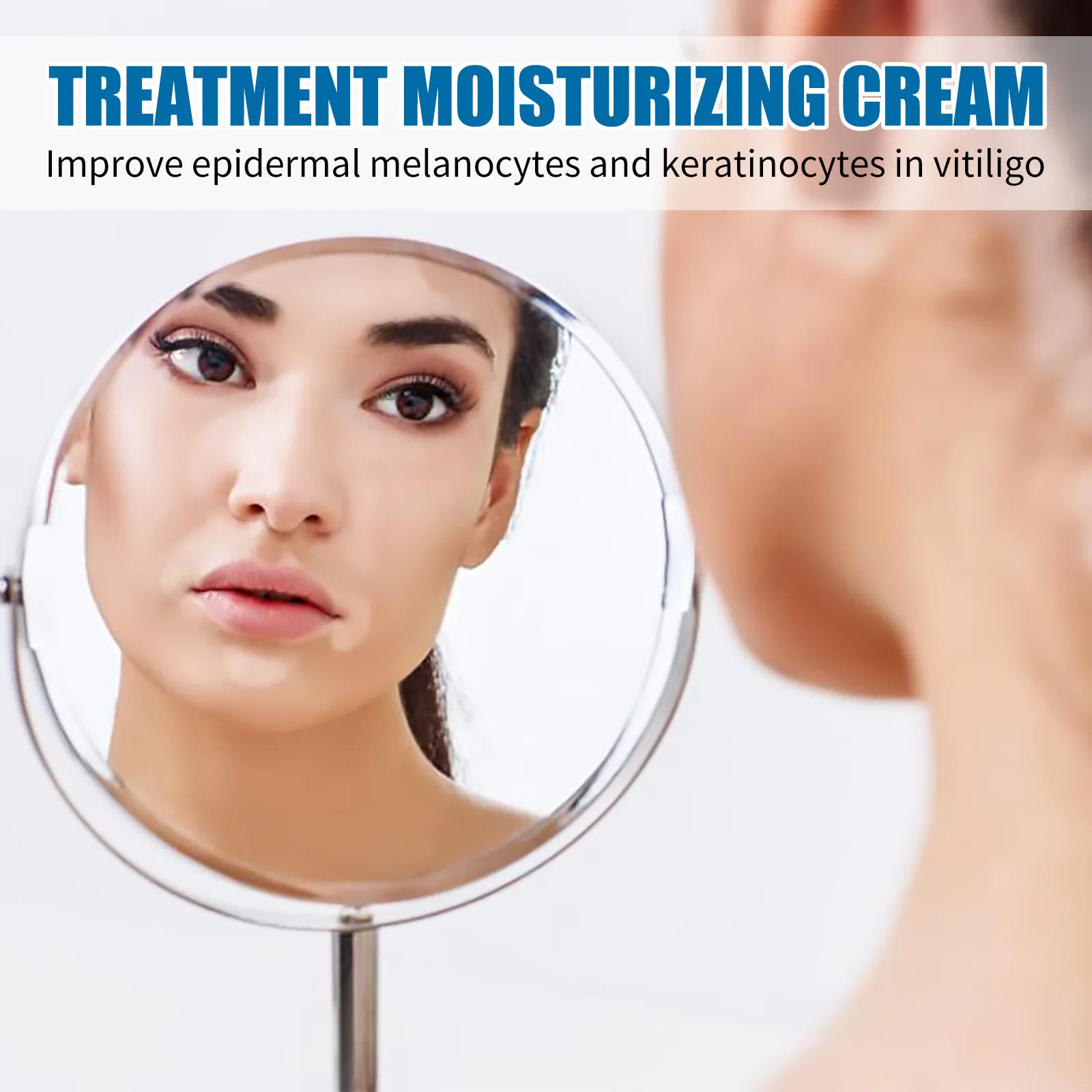 South Moon Vitiligo Treatment Ointment Antibacterial Remove White Spot Ringworm Skin Leukoplakia Disease Dermatitis Cream 20ml