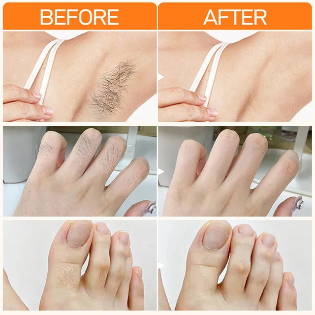 Depilação Indolor com Wax Painless
