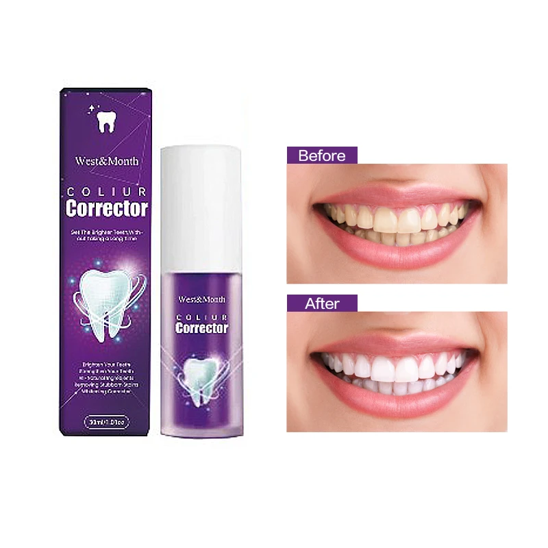 30ml סגול הלבנת משחת שיניים מסיר כתמים מפחית מצהיב טיפול שיניים חניכיים טרי נשימה מאיר שיניים