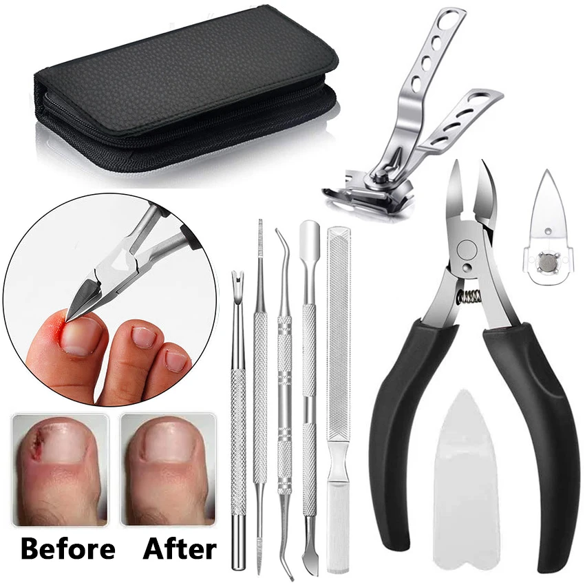 

Toe Nail Clippers Remove Dead Skin Nail Correction Nippers Ingrown Toenail Cuticle Scissor Edge Cutter Thick Pedicure Care Tools