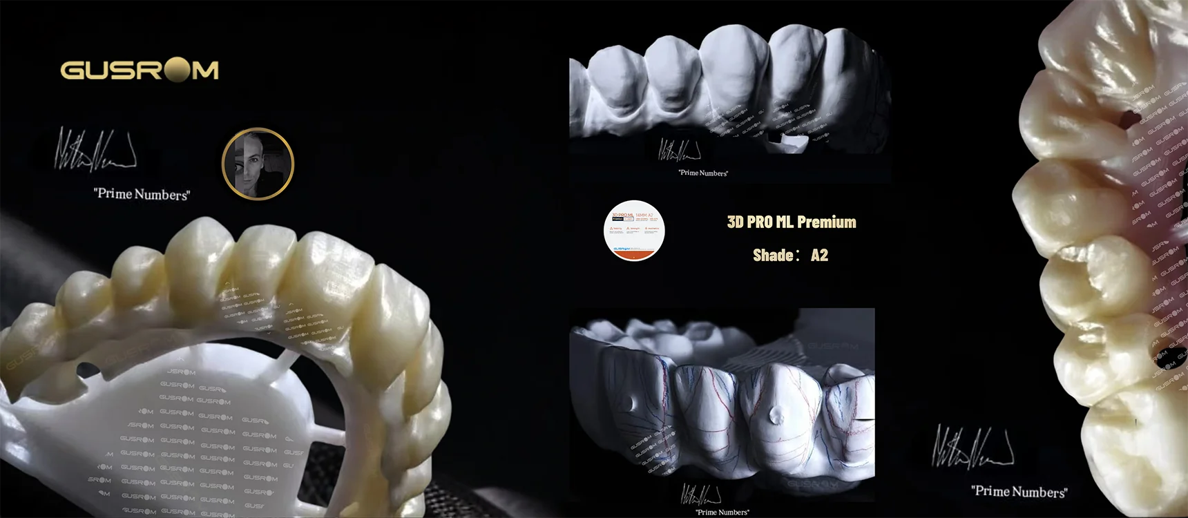 GUSROM 3D PRO ML Premium Mehrschichtiger Zirkonoxid-Block 98mm 6 Schichten 1200MPa Hochfestigkeit 57% Transluzenz Dental CAD CAM Kronenblock – Detail 2