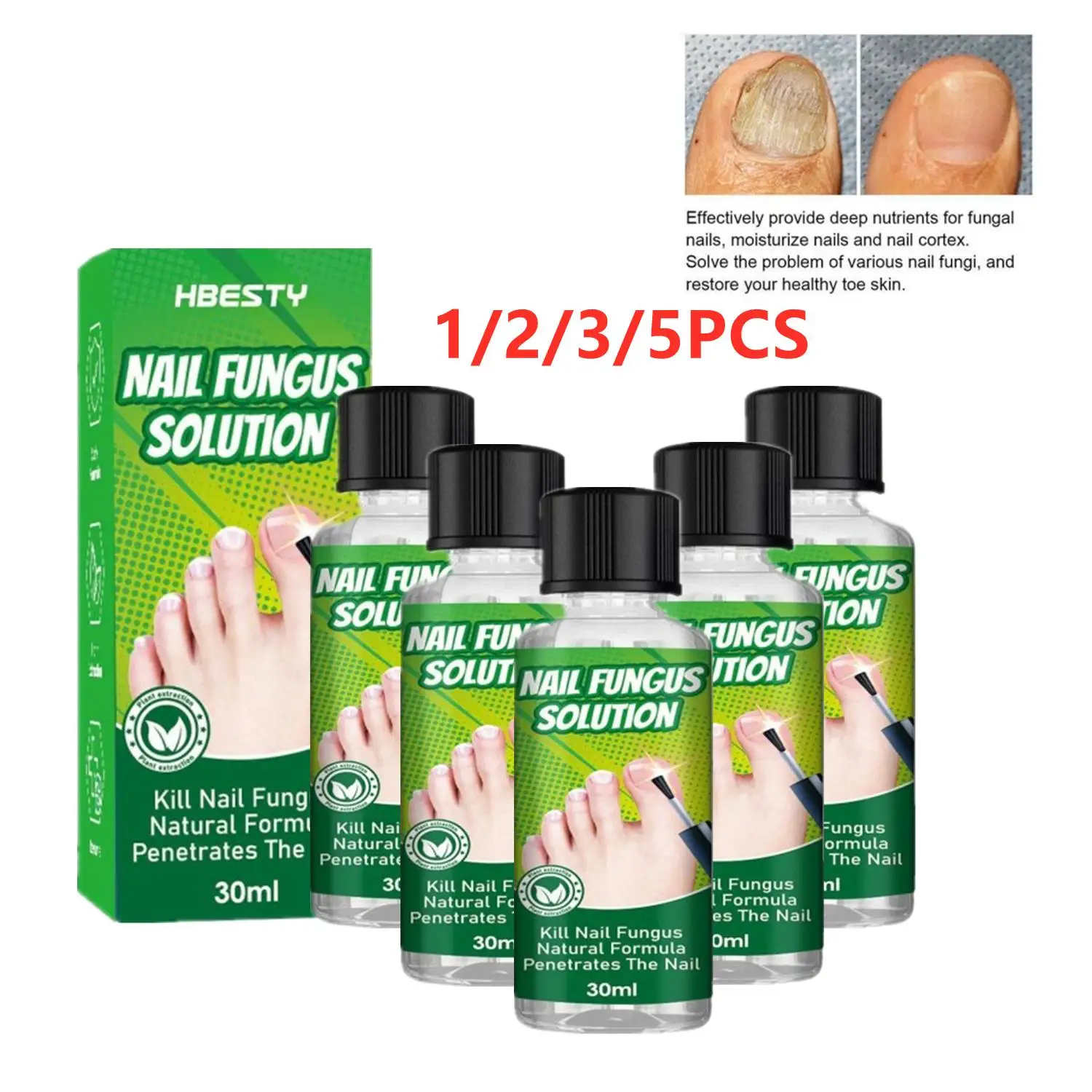 

LOT Nail Fungus Treatment Liquid Nail Repair Serum Toenail Fingernail Anti-Fungal Repair Oil Nail Growth Polish Foot Care 30ml