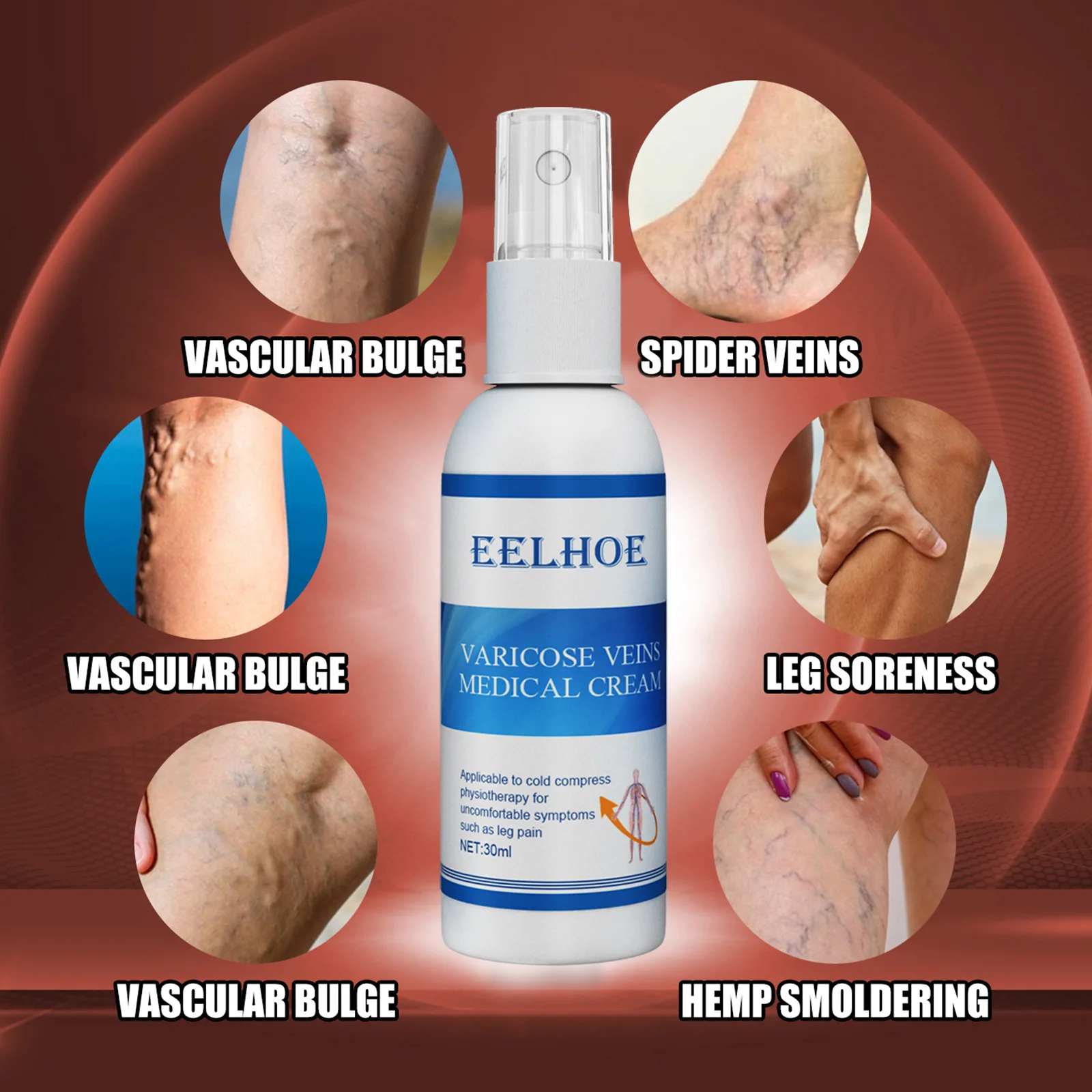 Varicose vein treatment spray for improving circulation and reducing leg vein appearance Varicose vein treatment spray for improving circulation and reducing leg vein appearance