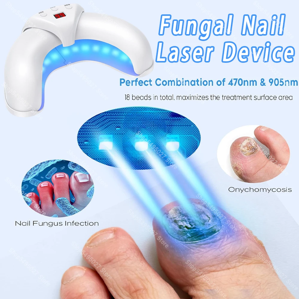 Nail Fungus Laser Device Toenail Laser Therapy Machine Anti Fungal Equipment Onychomycosis 910nm 407nm nail fungus remover personal health care laser therapy pen