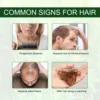 Hair Growth Oil Fast Growing Hair Effective Essential Baldness Repair Hereditary Anti Postpartum Seborrheic Hair Loss Products 6