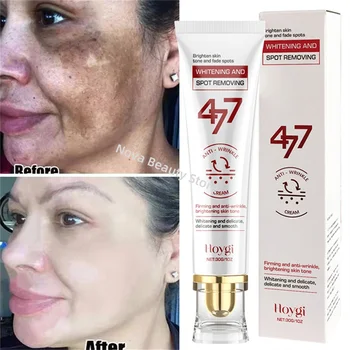 Powerful Spot-Removing cream 1