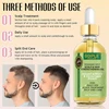 Braid Cleansing Care Set Dreadlock Shampoo for All Hair Types Braiding Mousse Rosemary Oil for Moisturizing Hair Scalp Soothing 6