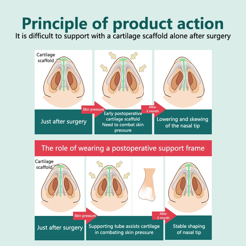 Nose Clip Nostril Opener Dilators Nose Shaper Postoperative Rhinoplasty Silicone Fixator Crooked Nose Correction
