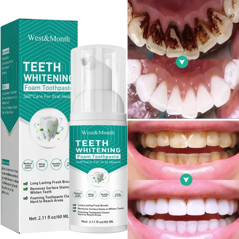

Teeth Whitening Mousse Dental Care Essence Remove Plaque Tooth Stain Gingival Repair Caries Prevention Oral Cleaning Products