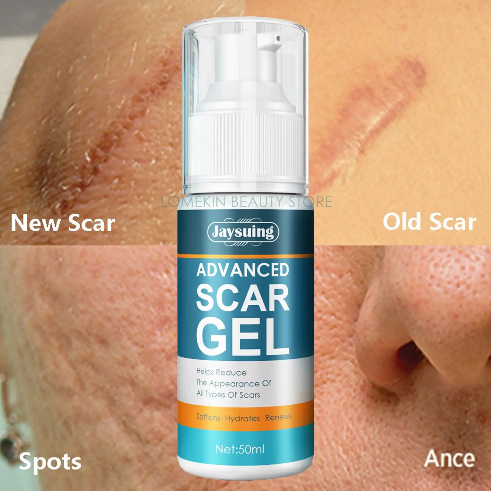 Advanced Scar Removal Cream Remove Body Stretch Marks Smoothing Acne Pimples Repair Gel Burn