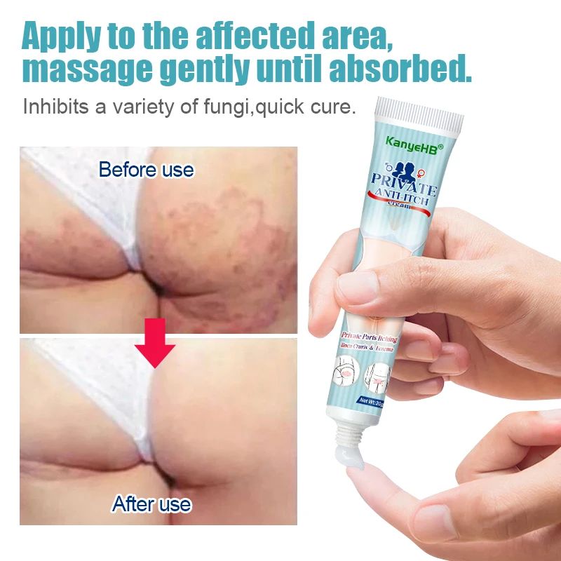 1pcs Men's Antibacterial Cream Anti-itch Anti-fungal Penis Pruritus Private Odor Psoriasis Cream Rash Jock Itch Eczema G015 antibacterial anti fungal cream