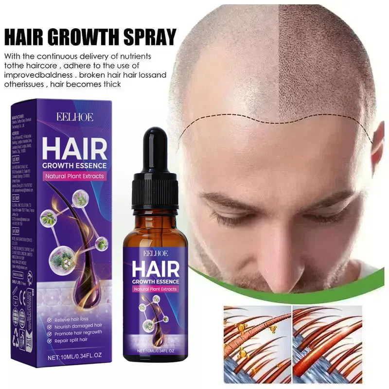 Hair Growth Oil Have More And More Hair Say Goodbye To Baldness Thick Hair