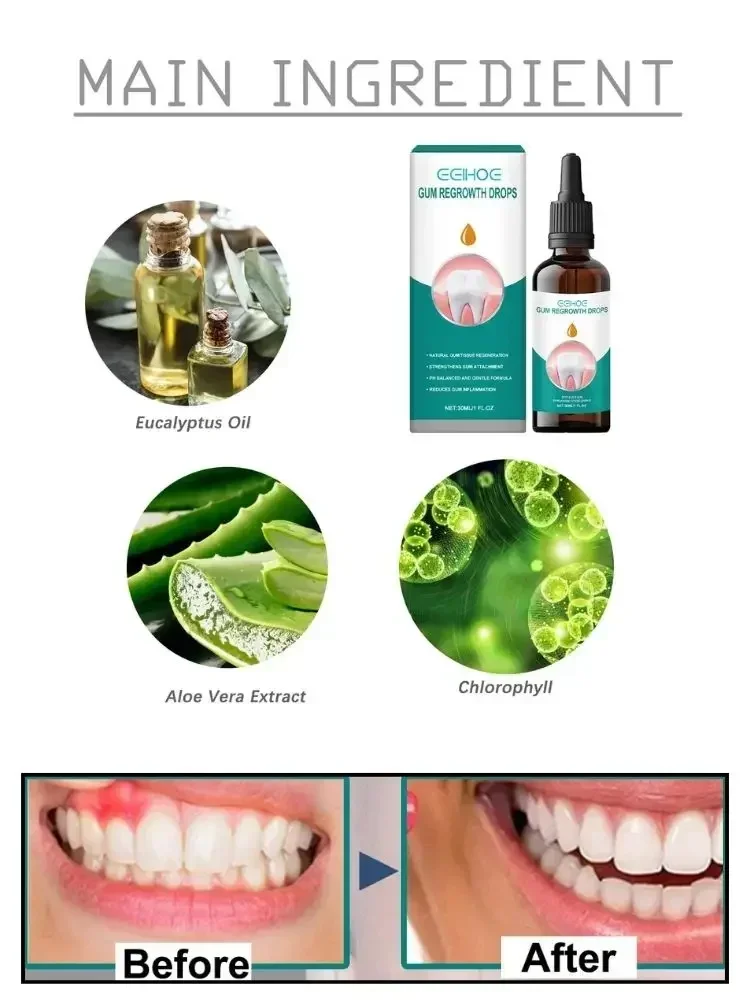 S&eacute;rum r&eacute;parateur de gencives rines, dentifrice, allergie dentaire, caries dentaires