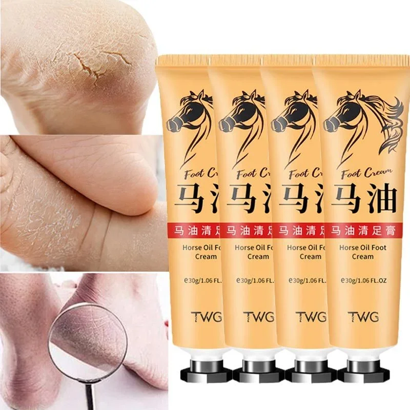 Hot Horse Oil Hand Foot Repair Cream Skin Moisturizing Foot Skin Care Repair Cream Removal Dead Skin Feet CareTreatment For Leg 3