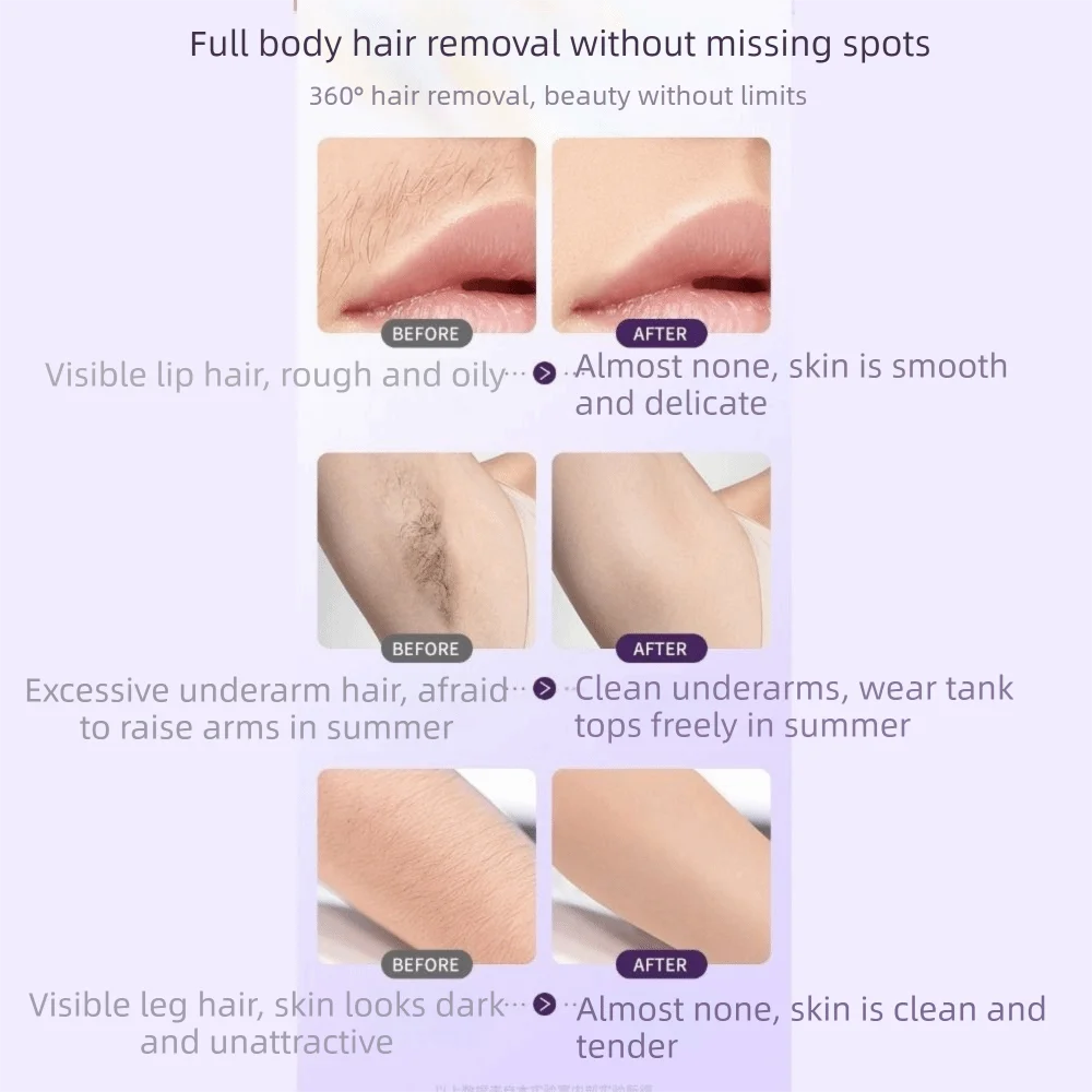 USB Rechargeable 2-in-1 Hair Removal Machine Wet Dry Use Painless Electric Razor Waterproof Detachable Body Trimmer