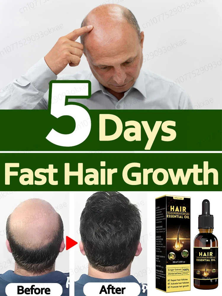 

Сыворотка для быстрого роста волос для лечения alopecia areata, seborrheic alopecia, herediary alopecia и т. д.