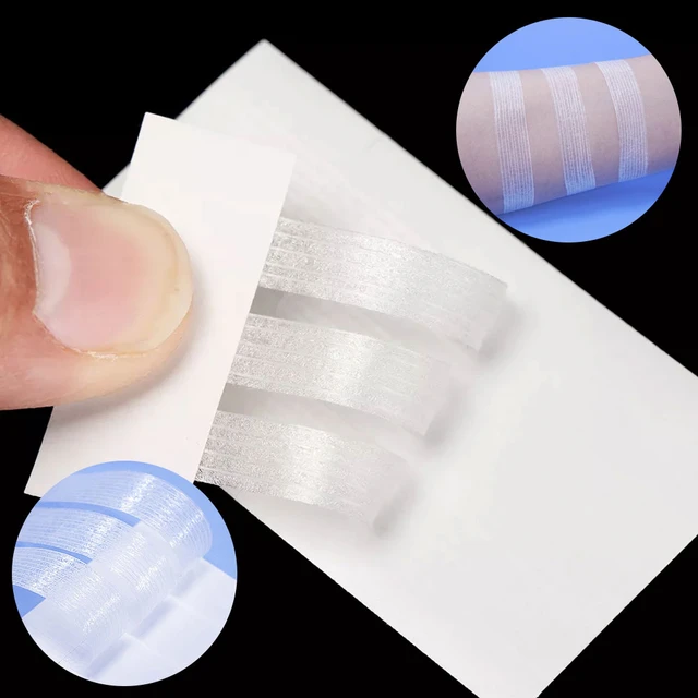  Mediss Disposable Skin Wound Closures Band Aid