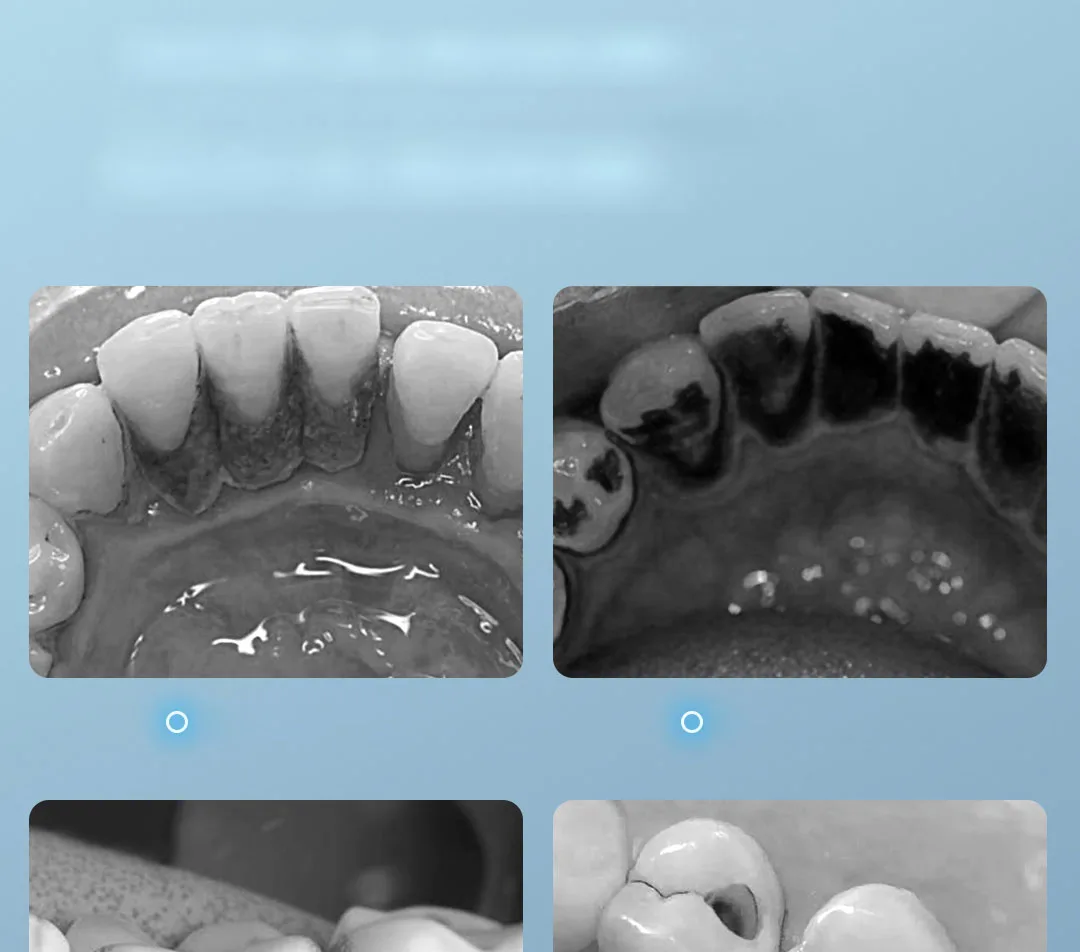 XIAOMI SUNUO T12 Pro Ultrasonic Dental Oral Teeth Cleaner Removal Whitening description image 4