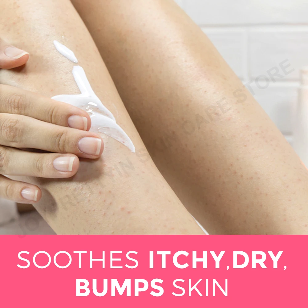 Whitening Body Cream 60g Body Skin Care Chicken Skin Removal Treatment Keratosis Pilaris Lotion Rough Bumpy Pore Spots Moisturizer